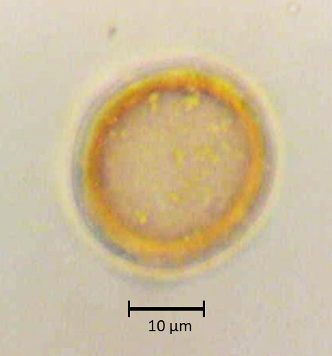 Hesperocyparis lusitanica