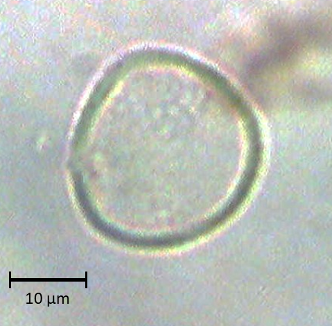 Polar 1