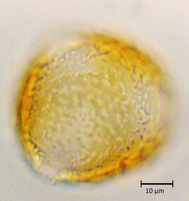 Strombocarpa strombulifera
