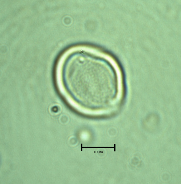 Polar 1