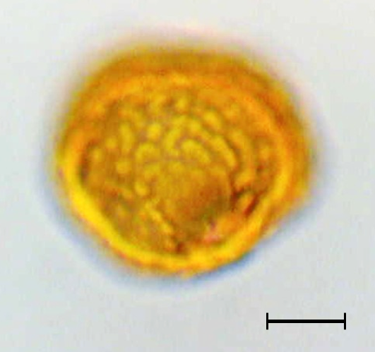Ulmus minor