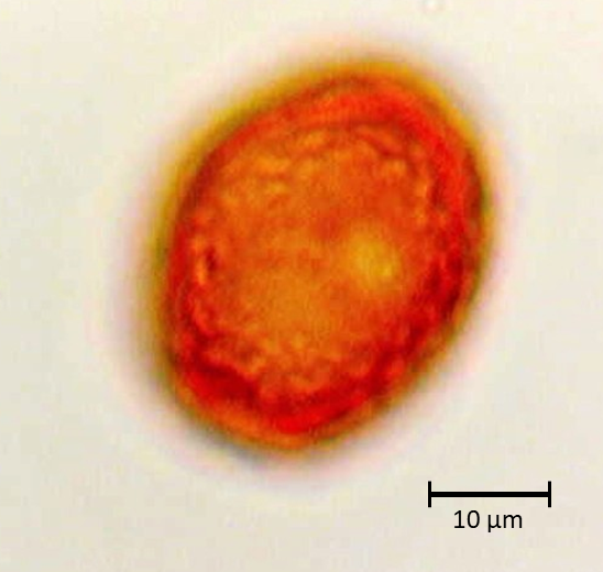 Ecuatorial 1