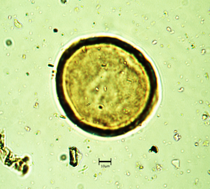 Araucaria4