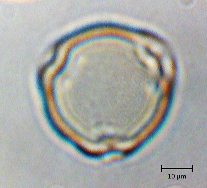 Polar 1
